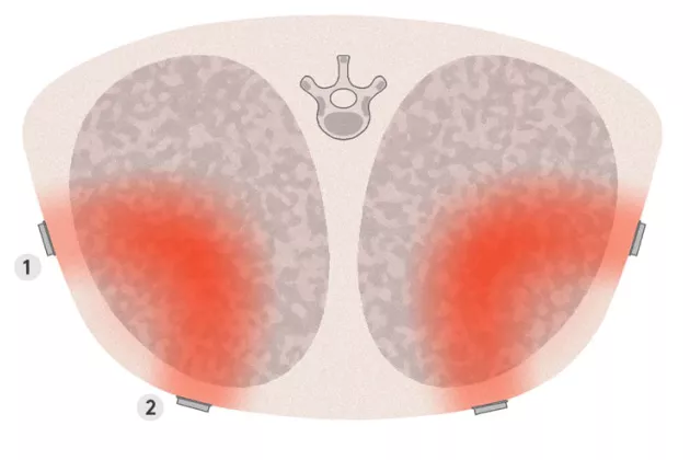 Two gray circles with one red arc inside each. Illustration.